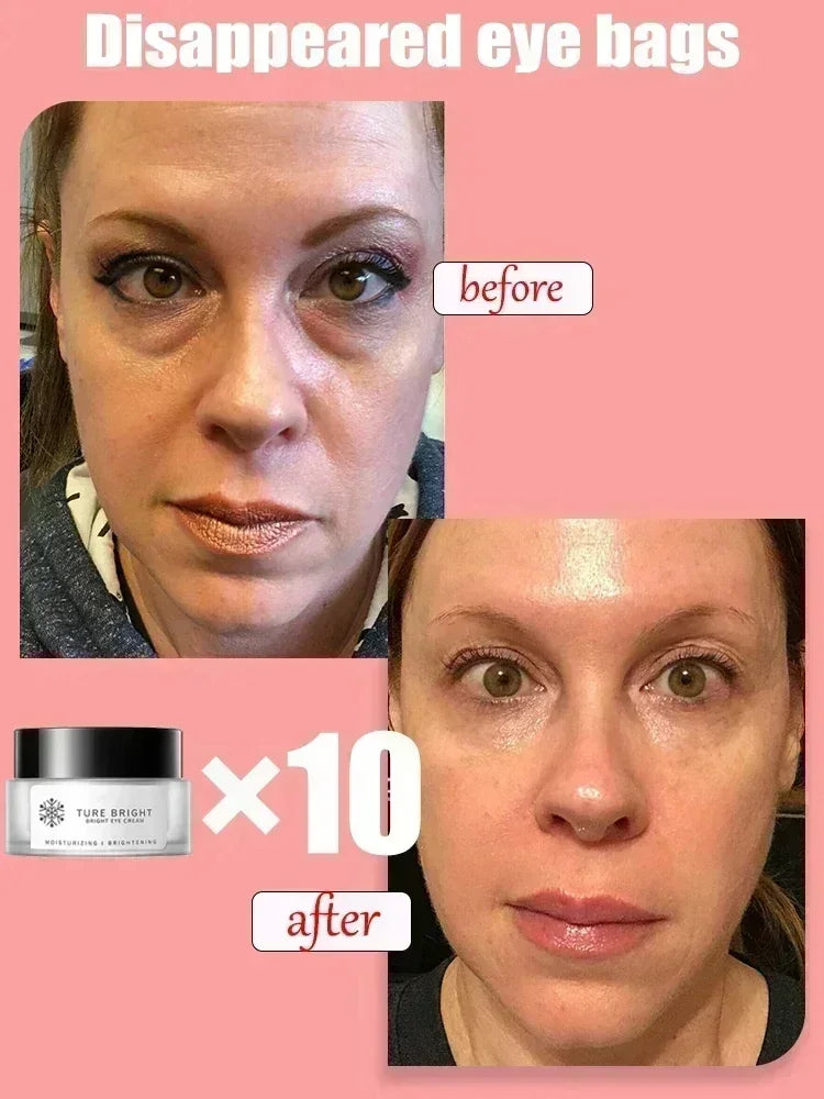 Eye cream for bags under the eyes Anti-Wrinkle instant firm eyes tightening Reduces Fine Line Moisturizing korean skin care