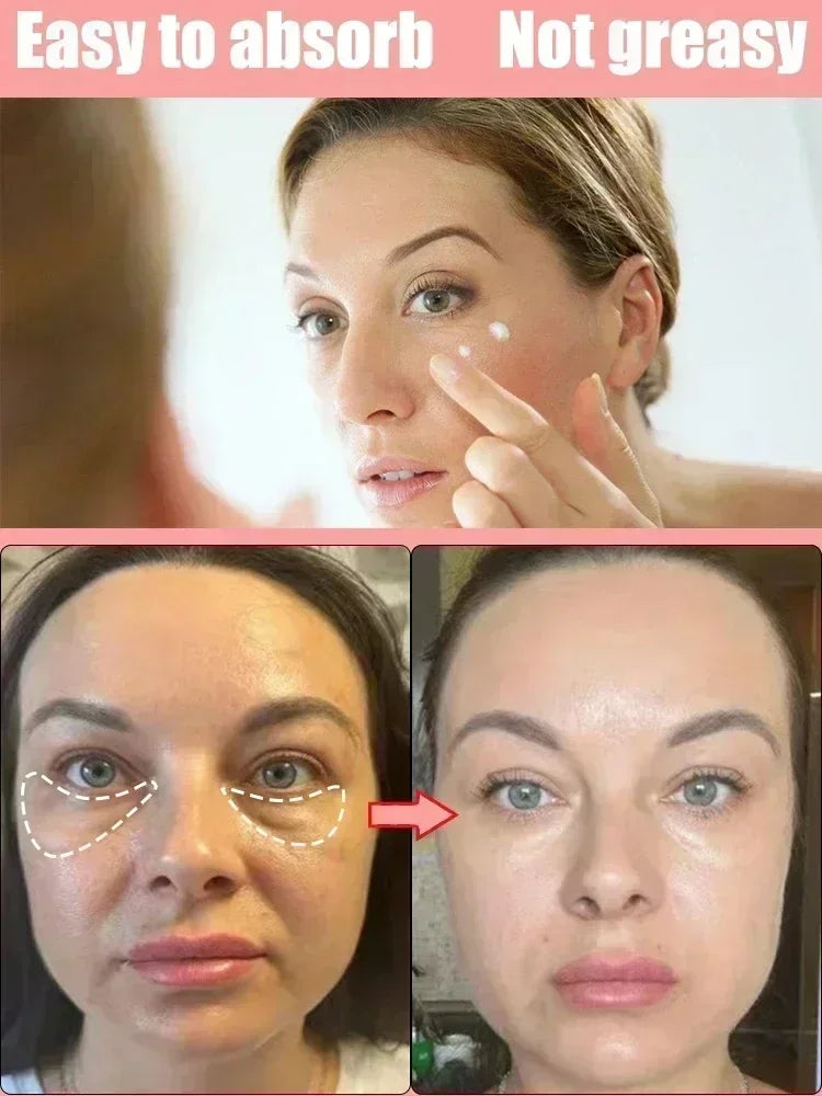 Eye cream for bags under the eyes Anti-Wrinkle instant firm eyes tightening Reduces Fine Line Moisturizing korean skin care