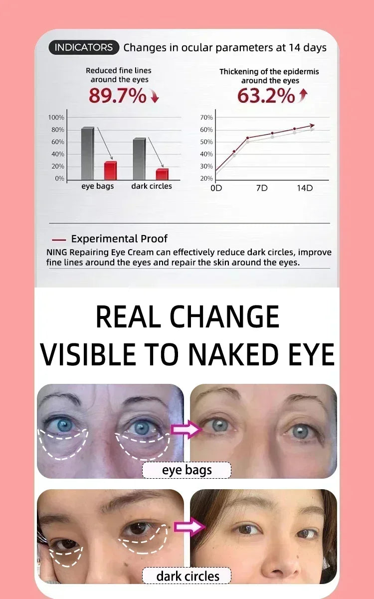 Eye cream for bags under the eyes Anti-Wrinkle instant firm eyes tightening Reduces Fine Line Moisturizing korean skin care