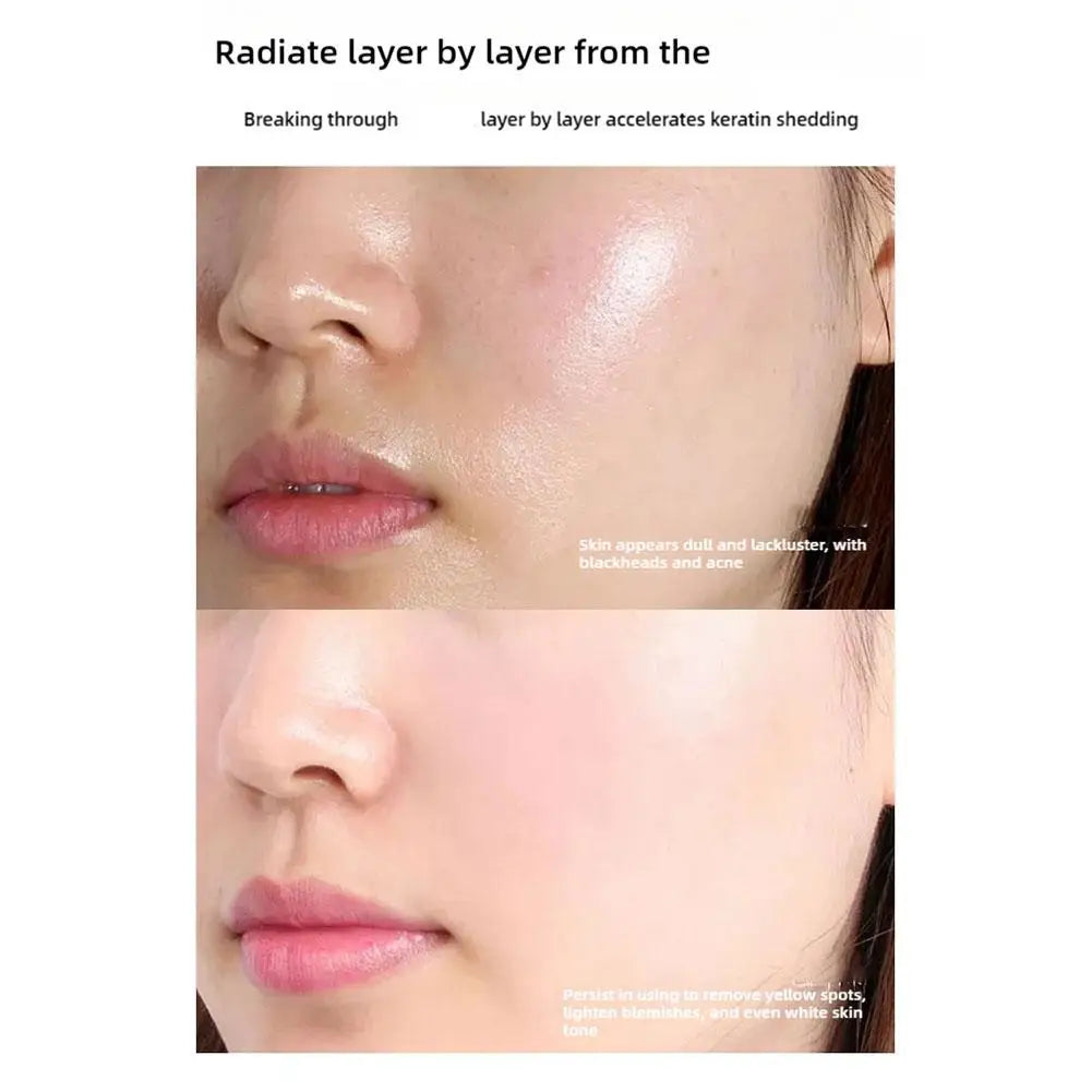 Glow Peel-Off Mask,Blemish Clearing Wrapping Facial Mask,Anti-Blemish Freckle Brightening Off Mask For Deeply Clean Moisturizing