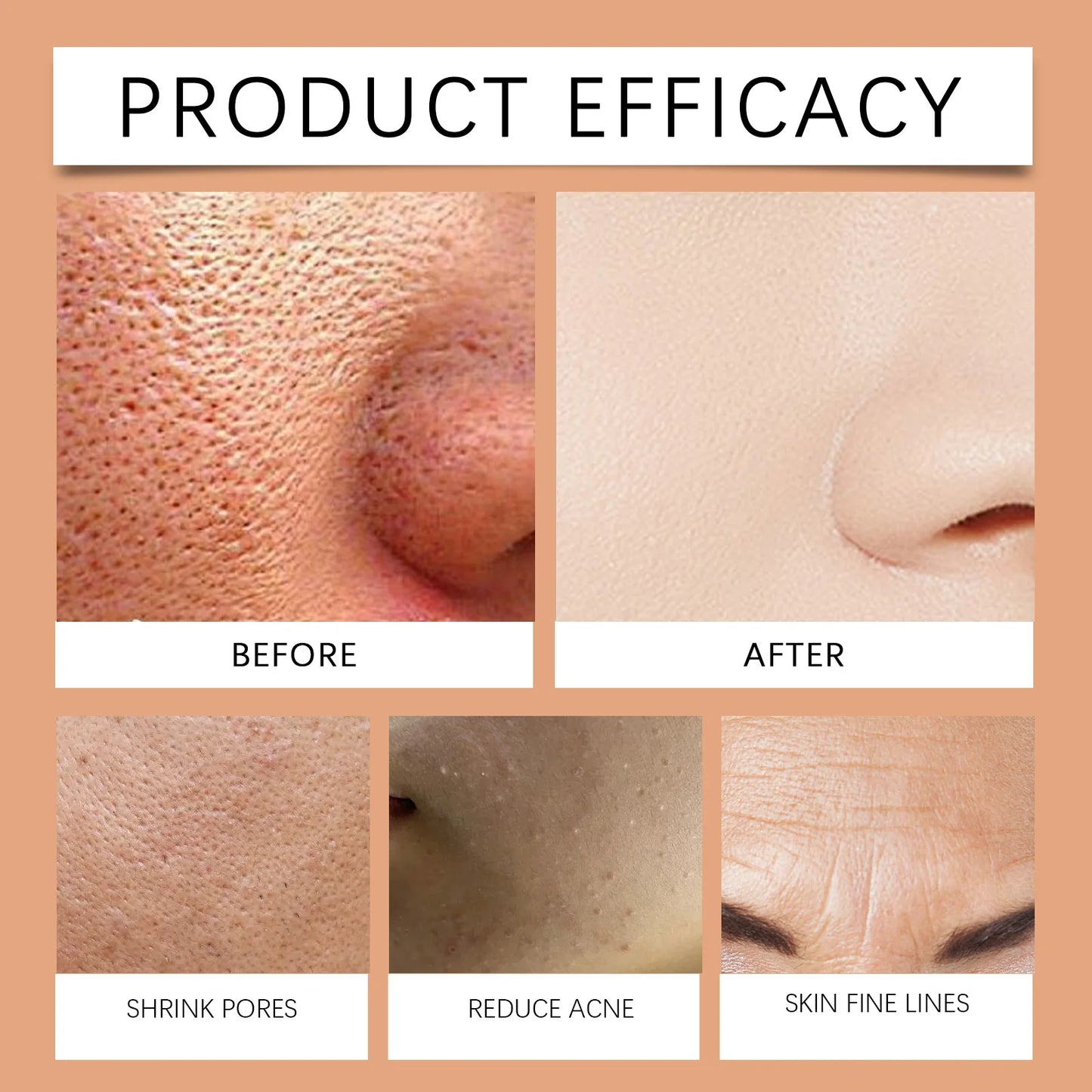 Facial Exfoliating Cream Clear Pores Shrink Improve Dullness Fade Dark Spot Soften Cuticle Remove Dirt Grease Face Cleansing Gel