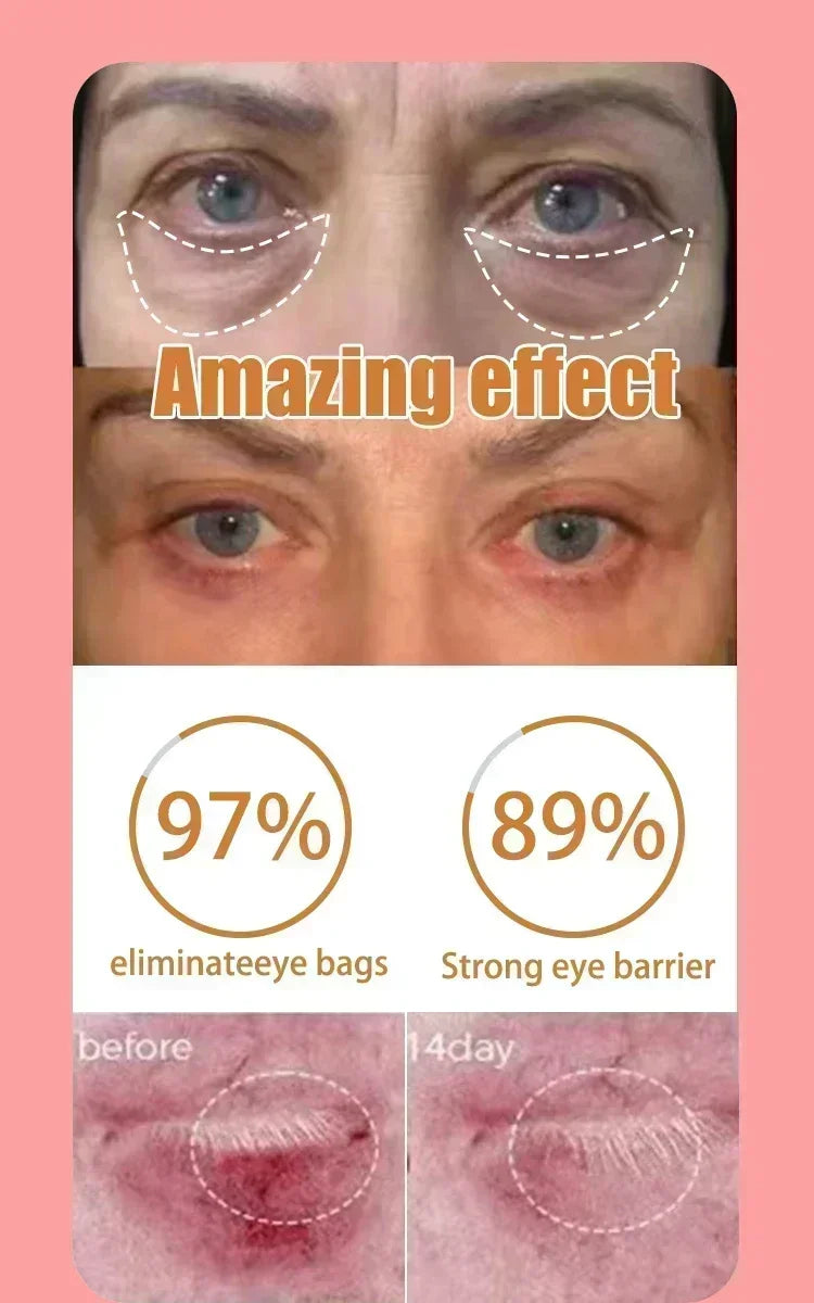 Eye cream for bags under the eyes Anti-Wrinkle instant firm eyes tightening Reduces Fine Line Moisturizing korean skin care