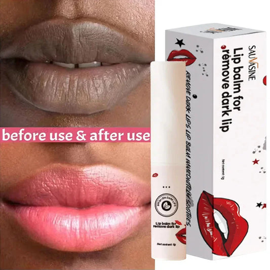 Lips Pink Fresh Lightening Bleaching Cream Treatment Remove Dark Smoke Lips Lip Balm Whitening Moisturizer Nourishing Essence