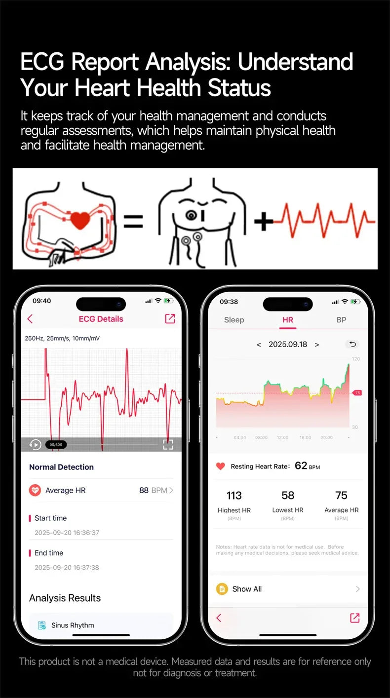 2026New Smart Watch Men Sport ECG Heart Rate Blood Pressure Health Diagnosis Sport Fitness tracking Smartwatches For Men women - Wear444