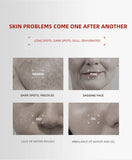 377 Water and Milk Set Moisturizing Improve Dullness Brightening Moisturizing Essence Cream Skin Care