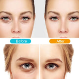 3D EMS Eye Massager Eyes Relax Fatigue Relief Lighten Dark Circles Smooth Micro-Current Heating Eye Fine Line Beauty Eye Care