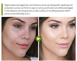 Tea Tree Oil Moisturizer Face Body Skin Care Reducing Acne Scars Repair Facial Serum Oil Control Pores Shrinking Clear Skin