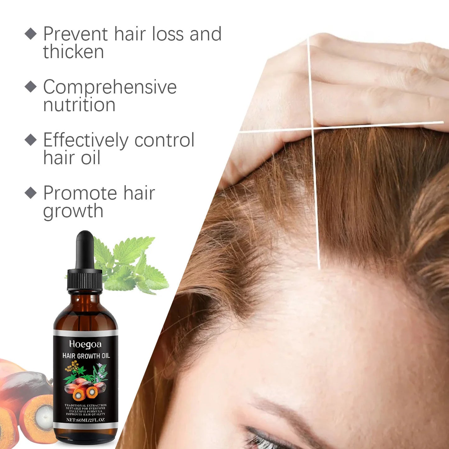 Hair Care Essence Oil Nourishing Treatments Scalp Dry Damaged Hair Regrowth Preventing Baldness Health Hair Growth Liquid 60ml