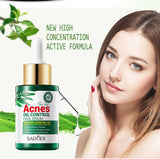 Tea Tree Oil Moisturizer Face Body Skin Care Reducing Acne Scars Repair Facial Serum Oil Control Pores Shrinking Clear Skin