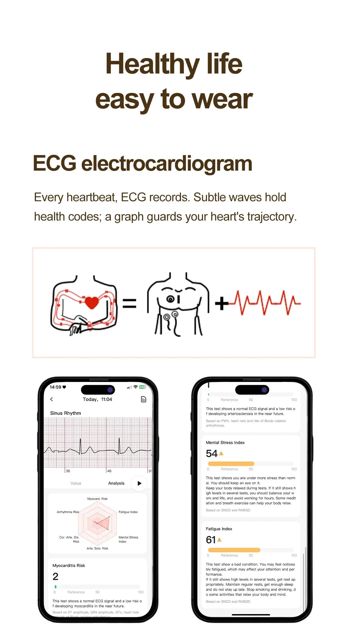 2026 New Women AI Smart Diagnosis Smart Watch HRV+ECG Uric Acid Blood Oxygen Health Monitor IP68 Waterproof Sports Smartwatches - Wear444