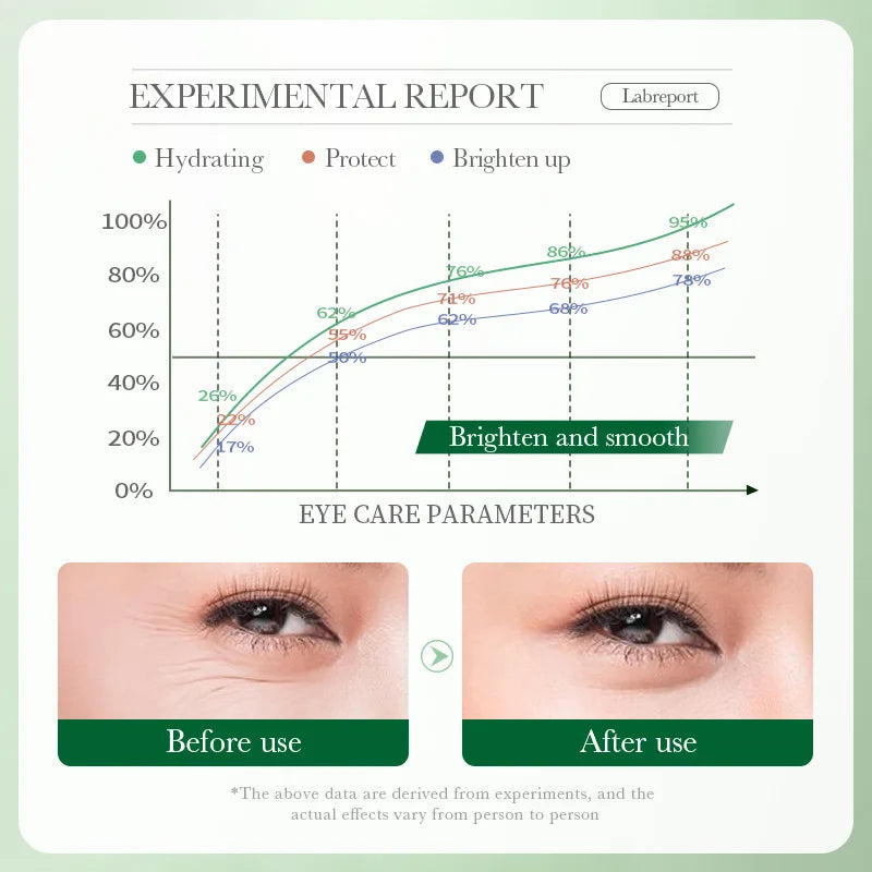 Centella Asiatica Eye Cream Anti Dark Circles Eyes Bags Moisturizing Anti Wrinkle Anti-aging Beauty Eyes Skin Care Products