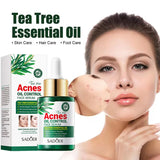 Tea Tree Oil Moisturizer Face Body Skin Care Reducing Acne Scars Repair Facial Serum Oil Control Pores Shrinking Clear Skin