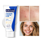 Acne Foaming Wash Benzoyl Peroxide 10% Maximum Antimicrobia Moisturizers reduces redness For Face & Body Skin Care Face Wash