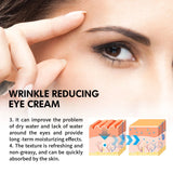 Hoygi Eye Care Cream 30g Hydrating and Nourishing for Under Eyes Reduces Dryness and Fine Lines Appearance Lightweight Soothing