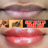 Lips Pink Fresh Lightening Bleaching Cream Reduce Pigmentation Remove Dark Smoke Lips GLow Moisturizer Essence Lip Care