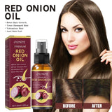 Onion Hair Essential Oil Spray for Hair Growth, Strengthens Hydrates Hair, Promotes Dense and Thick Hair Treatment 1/2PCS