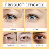 5% Coffee Eye Serum Fade Eye Fine Line Collagen Lightens Dark Circles Bags Puffiness Tighten Moisturizing Under Eyes Skin Care