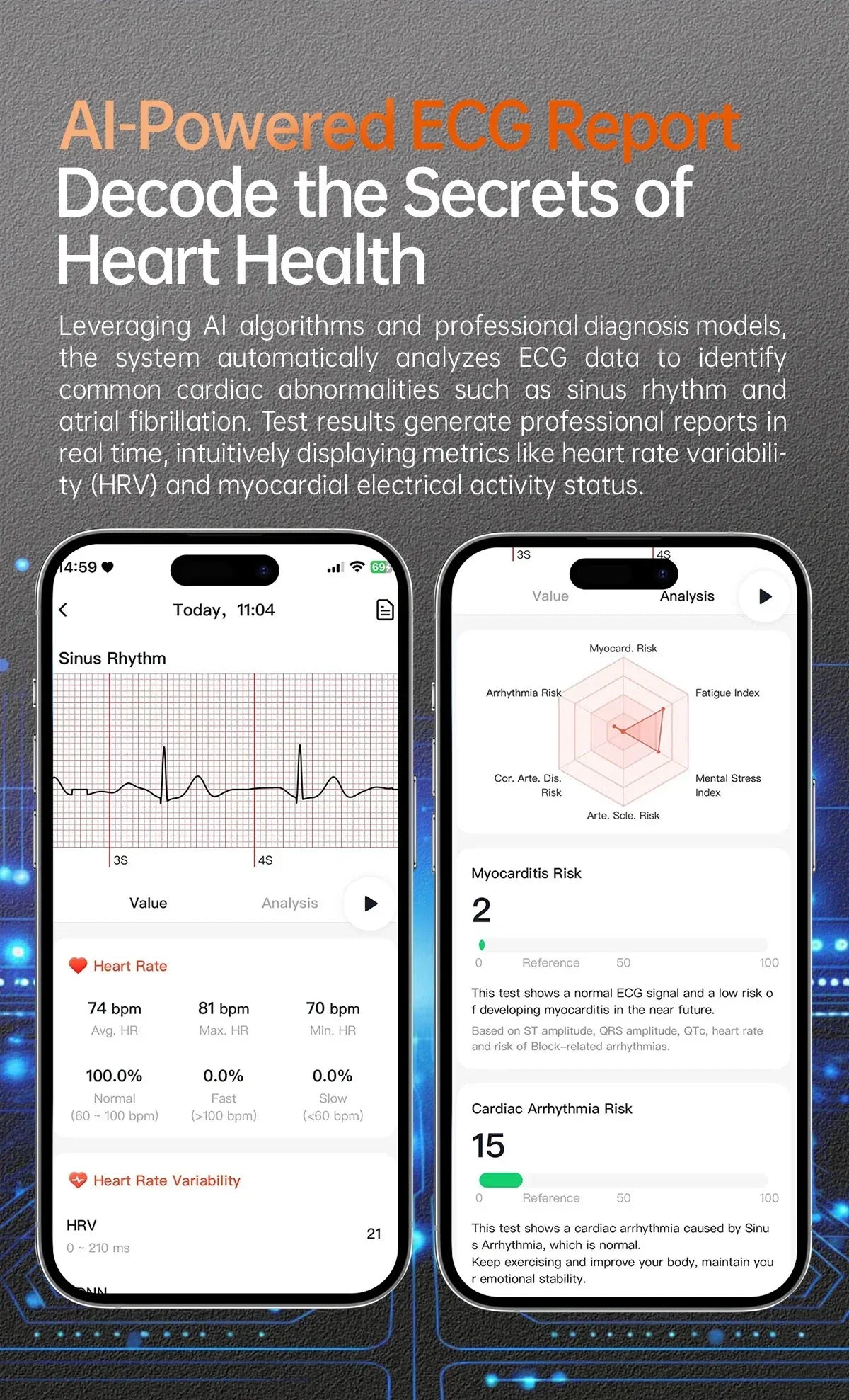 2025 New NFC+ECG+PPG Health Smart Watch BMI Fat Heart Rate Blood Pressure Watch 380mAh BT Call IP68 Waterproof Sports Bracelet - Wear444