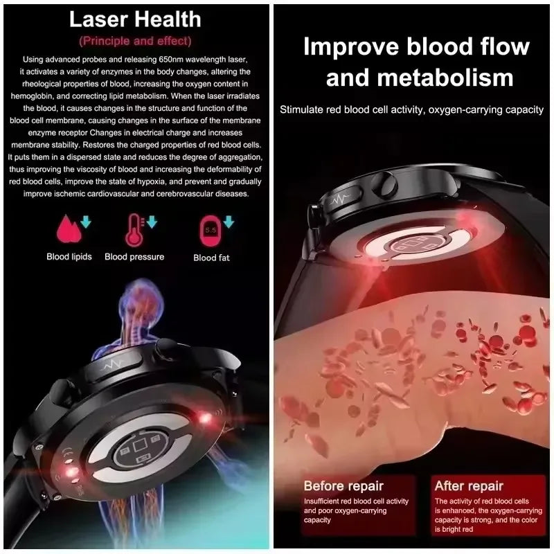 For Xiaomi Precise Laser Therapy Bracelet Uric Acid Blood Lipid ECG+PPG Health Smart Watch Bluetooth Call Smartwatches 2025 New - Wear444