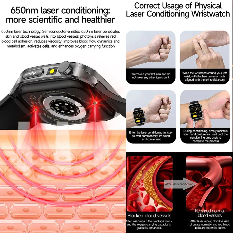 2025Hot AI-GPT Diagosis ECG Health SmartWatch Blood Pressure Lipid Uric Acid 650nm Dual-Probelaser Heart Analysis Smart bracelet - Wear444