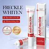 Whitening Cream Anti Freckle Face Cream, Remove The Black ，Melasma Dark Spot Acne Deposits On The Skin，Brightening Skin Care