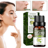 10ml Tea Tree Essential Oil Compound Plant Hydrating Oil-control Remove Pore Anti-acne Moisturizing Brighten Face Skin Care