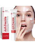Whitening Cream Anti Freckle Face Cream, Remove The Black ，Melasma Dark Spot Acne Deposits On The Skin，Brightening Skin Care