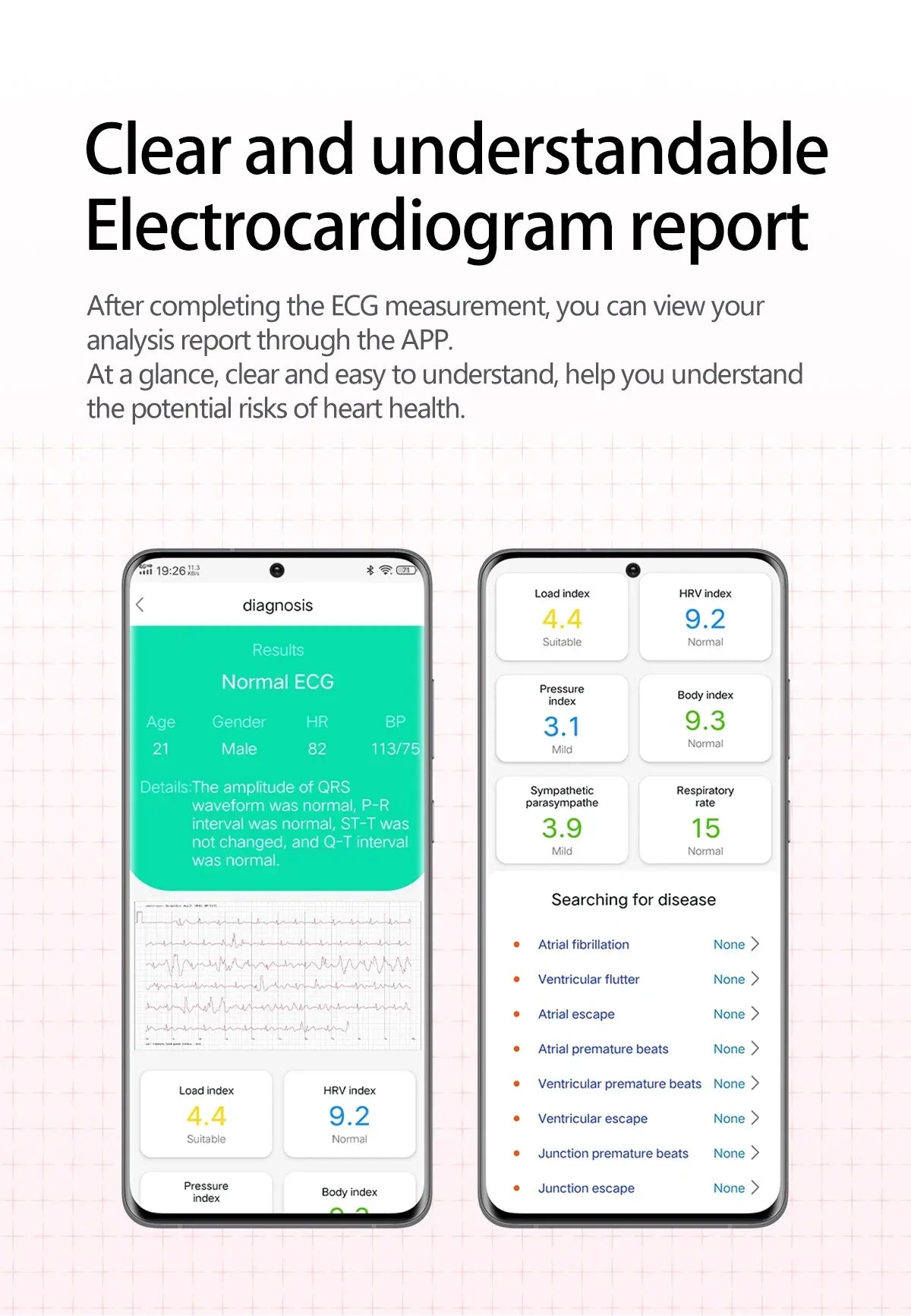 2025New Heart Health Analysi NFC Air Pump+Air Bag Smart Watch Men Accurate Blood Pressure Uric Acid ECG Call Smart Bracelet lady - Wear444