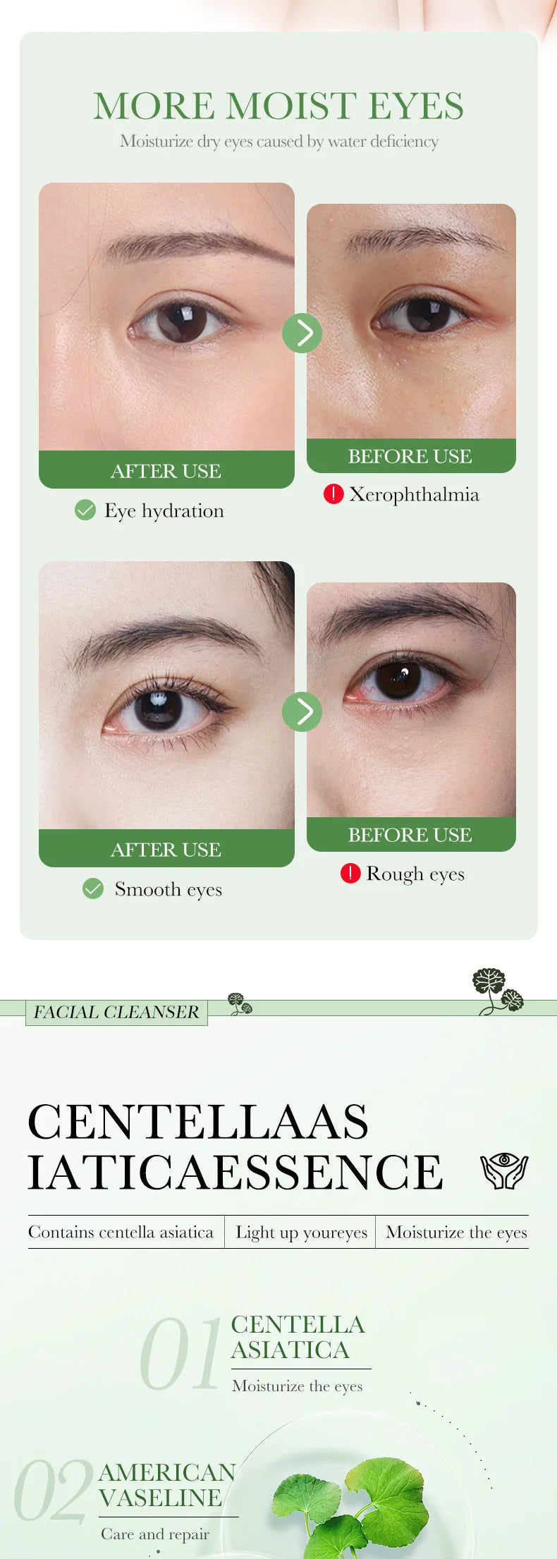 Centella Asiatica Eye Cream Anti Dark Circles Eyes Bags Moisturizing Anti Wrinkle Anti-aging Beauty Eyes Skin Care Products