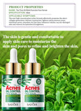 Tea Tree Oil Moisturizer Face Body Skin Care Reducing Acne Scars Repair Facial Serum Oil Control Pores Shrinking Clear Skin