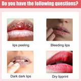 Lips Pink Fresh Lightening Bleaching Cream Reduce Pigmentation Remove Dark Smoke Lips GLow Moisturizer Essence Lip Care