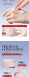 Whitening Cream Anti Freckle Face Cream, Remove The Black ，Melasma Dark Spot Acne Deposits On The Skin，Brightening Skin Care
