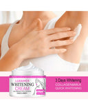 Whitening Face Cream Body Armpit Leg Knee Elbow Lighten Dark Spots Brighten Skin Tone Moisturizing Care Health Beauty Skin Care